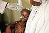 Bild från augusti, vid en klinik i Maiduguri i nordöstra Nigeria.